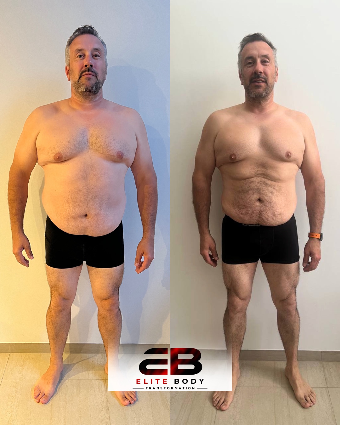 Évolution physique avant et après — série 21