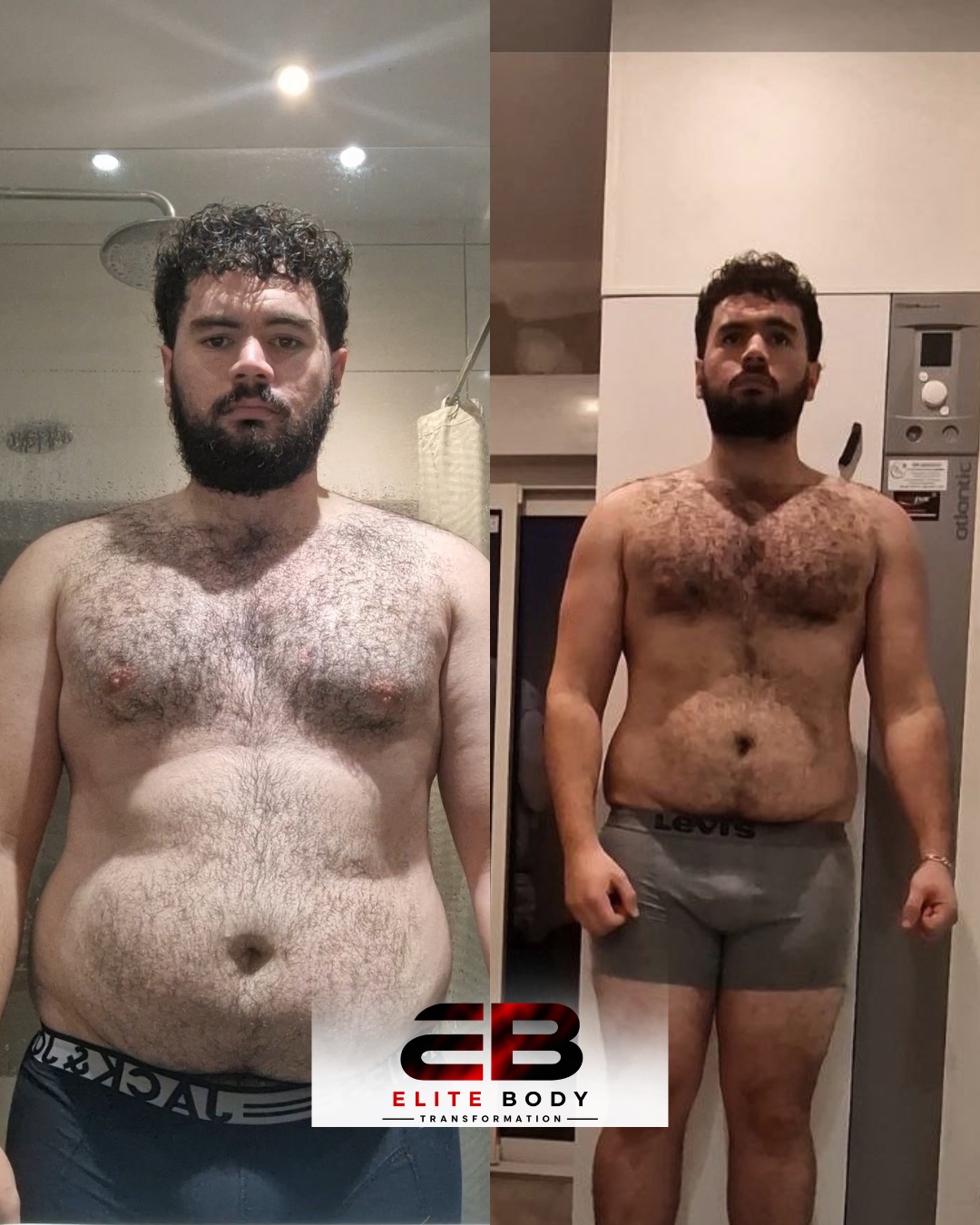 Évolution physique avant et après — série 32